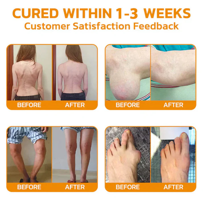 ✅ OFFICIAL STORE: Aeehfeng™ Lidocaine Free Pain Relief & Repair Solution 👨⚕️ South African Orthopaedic Association (SAOA) Certified