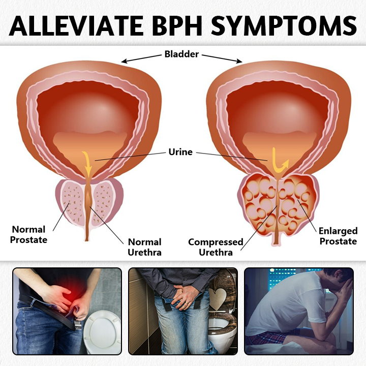 (🔥LAST DAY SALE-80% OFF) Miniyou™ ProstaMagnetic Harmony Ring