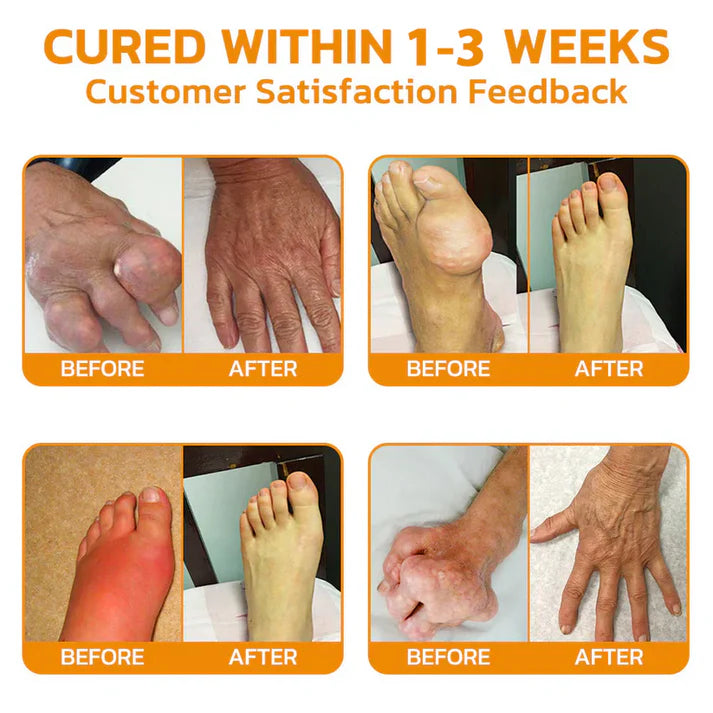 ✅ OFFICIAL STORE: Aeehfeng™ Lidocaine Free Pain Relief & Repair Solution 👨⚕️ South African Orthopaedic Association (SAOA) Certified