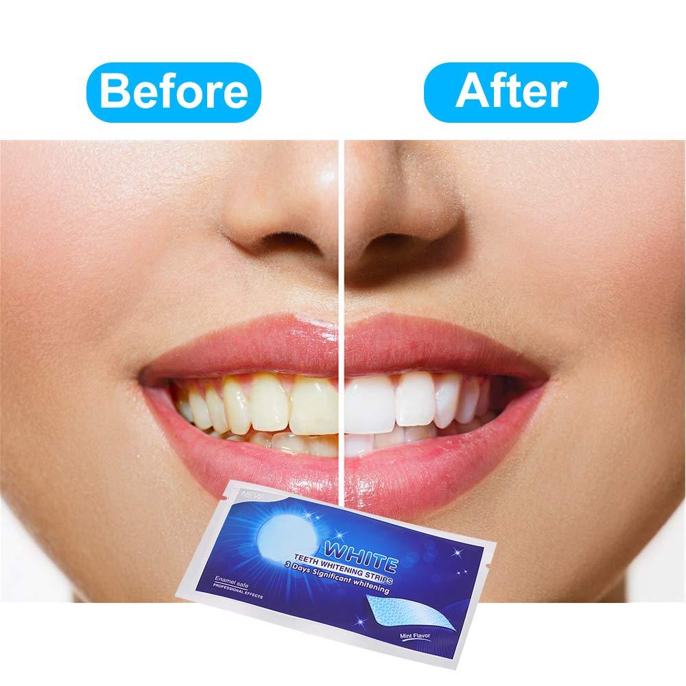 7PCS Teeth Whitening Strips【🇮🇳COD + Local Stock !!!】